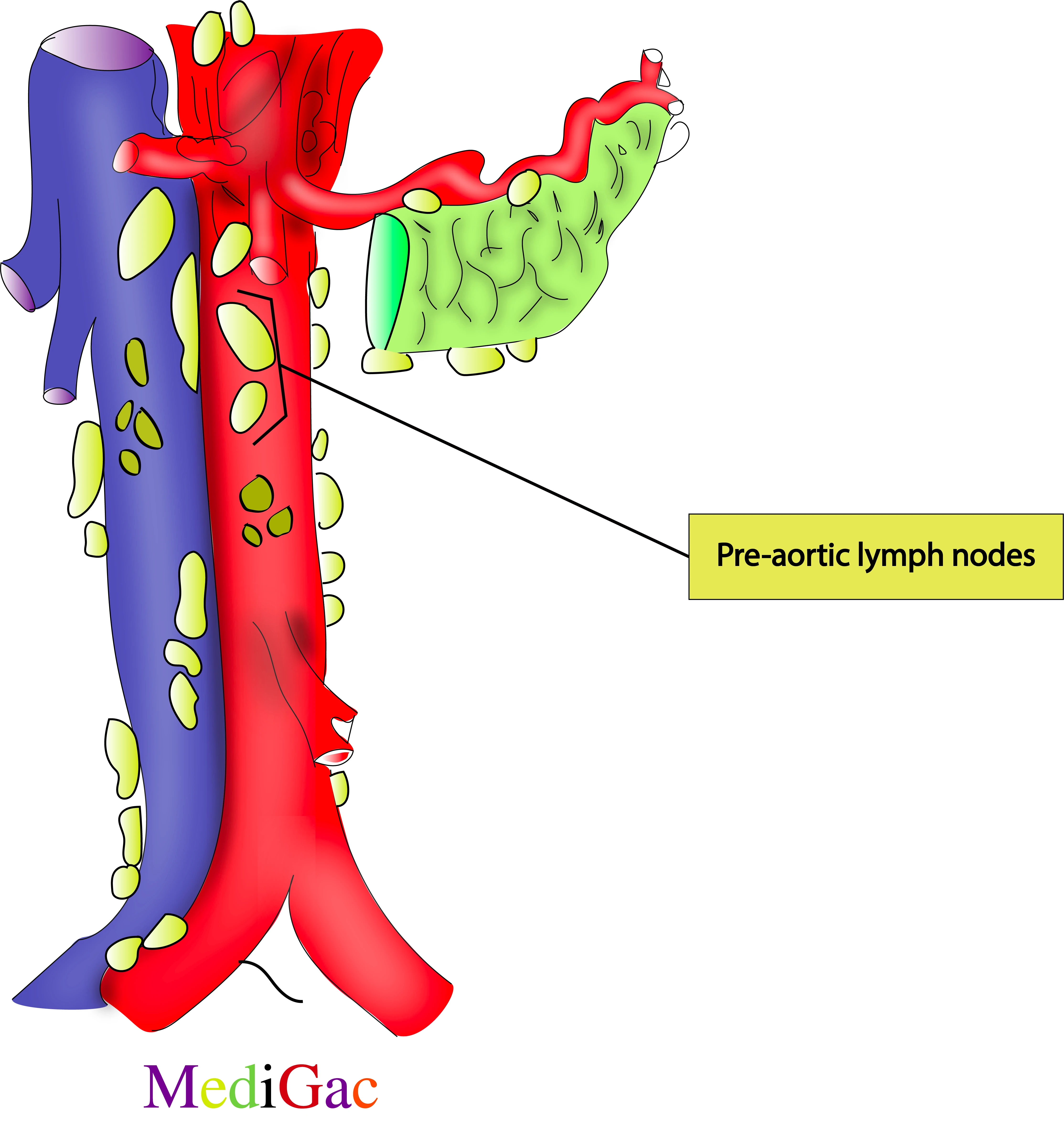 Pre-aortic lymph nodes